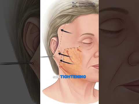 Logo of Expert Neck Lift Surgery Procedure in Bangkok, Thailand: Complete Evaluation Guide