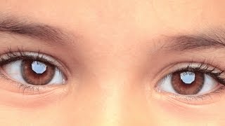 Cómo tratar la hipermetropía en los niños