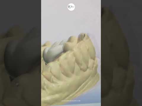 Alessandro Donzelli-22