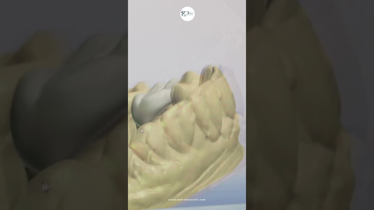 Alessandro Donzelli-22