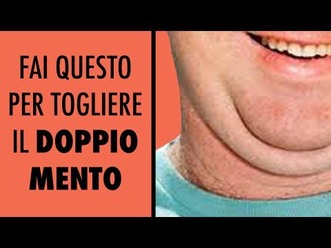 Come accentuare le lentiggini Come liberarsi da lentiggini è facile