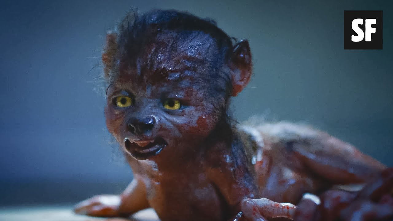 GAROTO NASCE COM APARÊNCIA DE UM LOBO