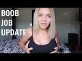 Boob Job Update Part 2 | 6 weeks post op Boob Job Update Part 2 | 6 weeks post op