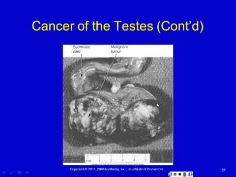 Disorders of the Reproductive System