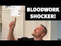 BLOODWORK SHOCKER - Why is my Free Test SO HIGH!? | Proof That Marc Lobliner is on ONLY TRT?