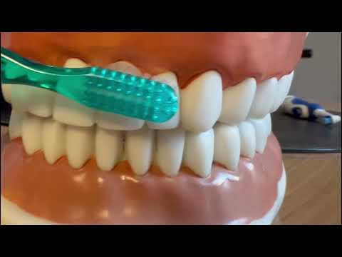 La tecnica corretta per spazzolare i denti durante l'igiene orale con lo spazzolino