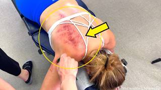 UNBELIEVABLE STRENGTH 😳 Weightlifter Has A STUCK Back! Cracking Her Spine TOOK An HOUR!