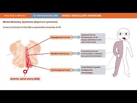Brainstem Blood Supply