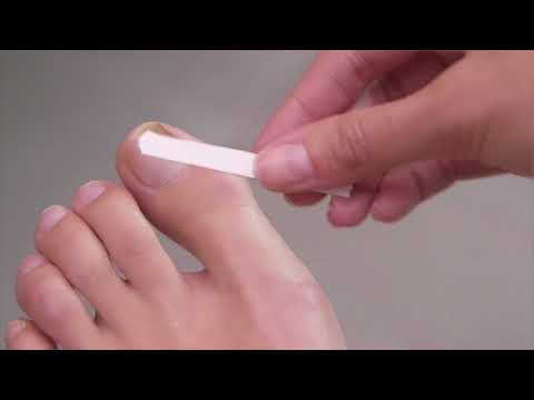How to use Schollmed Once Weekly* Fungal Nail Treatment