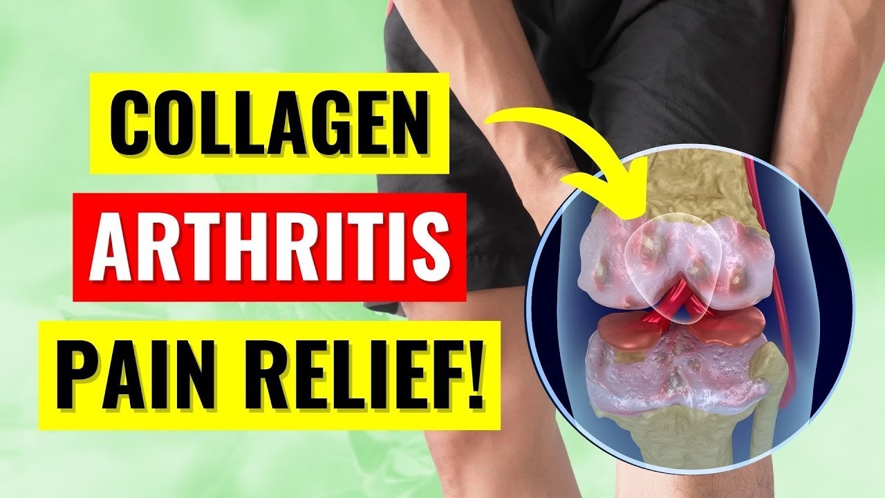 The Truth About Collagen for Arthritis Pain