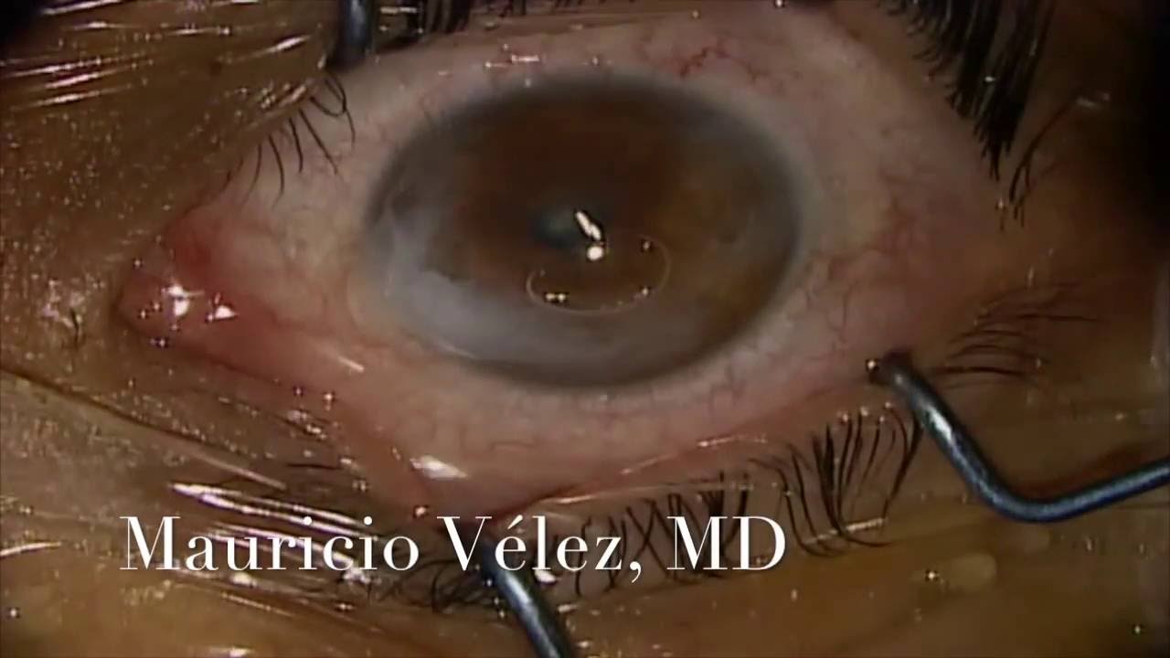 Mauricio Velez Fernandez-17