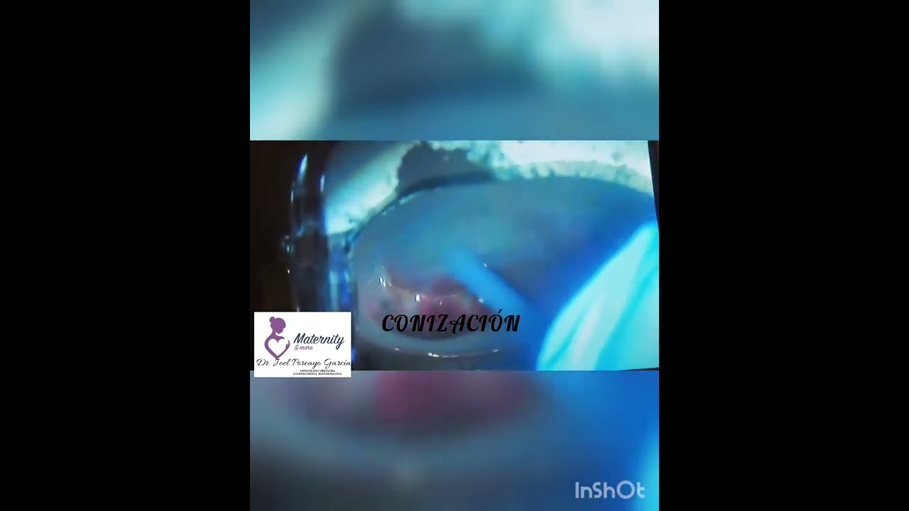 Joel Porcayo Garcia-28