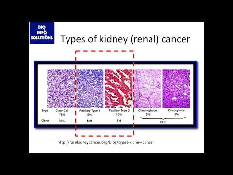 Rare Cancer Meta-Analysis, pt.1: Background on papillary renal cell carcinoma