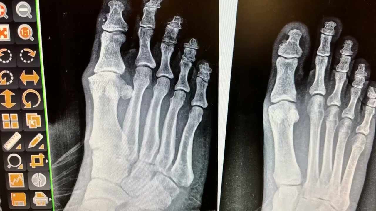 Long Island Podiatrist | Massapequa Foot & Ankle Specialist