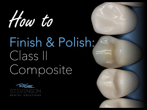 How To Finish And Polish A Class II Composite