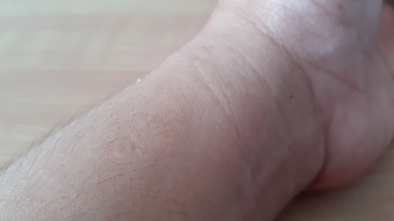 Putar video VISIBLE PULSE IN WRIST OF PREGNANT WOMAN | FILIPINA IN ROMANIA sekarang VISIBLE PULSE IN WRIST OF PREGNANT WOMAN | FILIPINA IN ROMANIA
