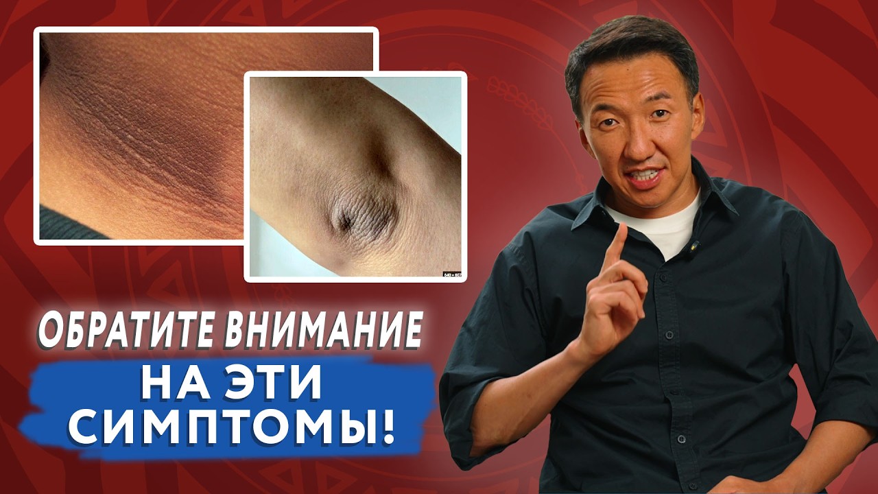 These 7 signs of DIABETES everyone should know! #DoctorZhimba