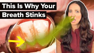 why your breath REALLY stinks (dental hygienist explains)