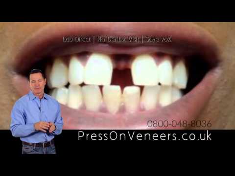 PressOn Veneers by Brighter Image Lab - Now in the UK
