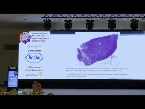 07 Pediatric lymphomas | Dr. Fadhel Alotaibi | 26 Oct 2024