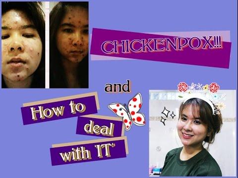 คนทำเต้านมซิลิโคน ราคาสำหรับพลาสติกหน้าอกในมอสโก