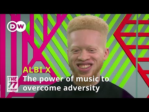 Albi X: "Don’t let anyone talk you down"