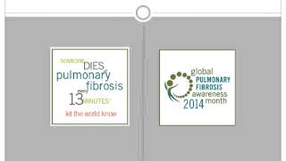 Blue it UP or Pay it Up Serenade in Blue Frank Sinatra