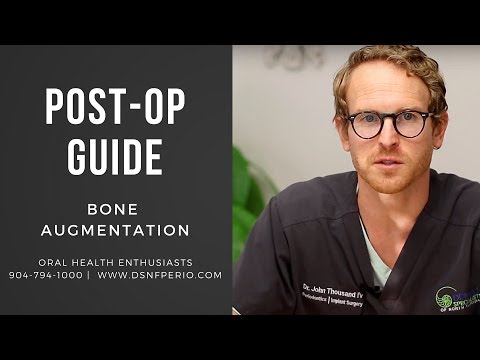 Post-Operative Guide To Bone Augmentation | Dr. John W. Thousand IV