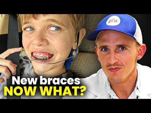 Just got Braces? Here's how to get comfortable