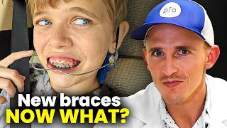 Just got Braces? Here's how to get comfortable