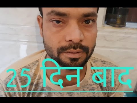 piles and Corneal Ulcer, का ईलाज ( Vol-2), By Veteran Ayurveda.