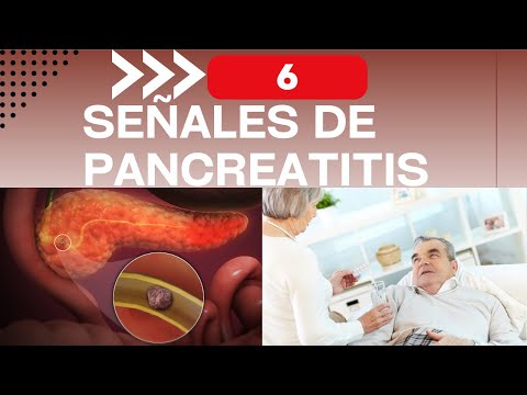 6 Signs That You Will Develop Pancreatitis