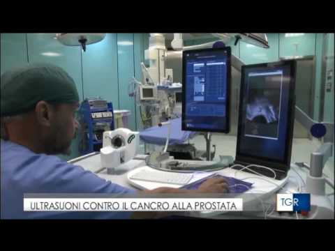 Pietra del costo trattamento laser prostata Come fare massaggio prostatico per sé il dito
