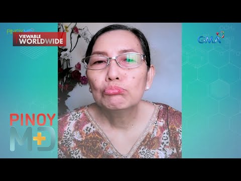 Ano ang dahilan ng singaw at paano ito malulunasan? Pinoy MD