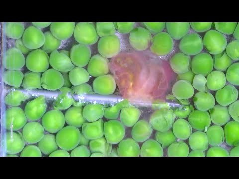 VAE EnCor Clinical Case Tips - BD Europe