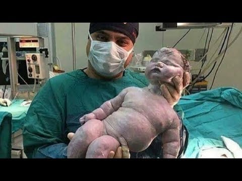 Woman Gives Birth To An 18.9 Pound Baby And People Online Are Going Crazy