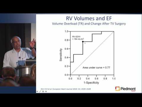 Top 10 Facts About Right Ventricular Function
