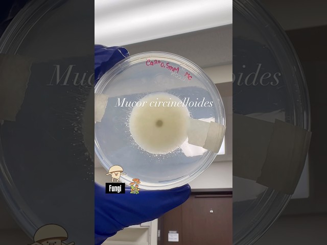 Vídeo relacionado con Fungi For Dummies