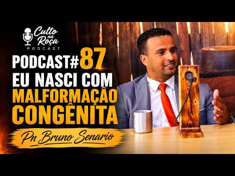 Podcast#87 Eu nasci com malformação congênita - Pr Bruno Senario
