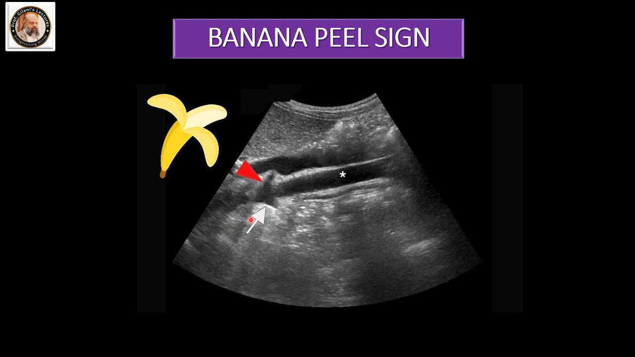 Tips For Abdominal Ultrasound