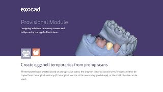 Exocad Provisional Module / Модуль Провизорных Конструкций