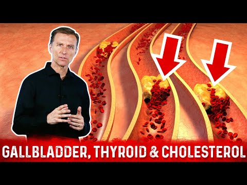 The Gallbladder, Thyroid & Cholesterol Link (Part - 4) – Dr. Berg Video