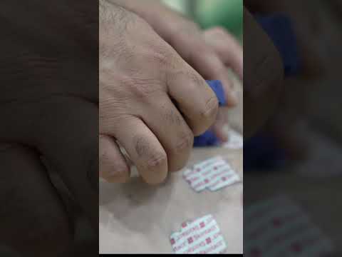 Champions League Players NEED ECG | MFC #shorts