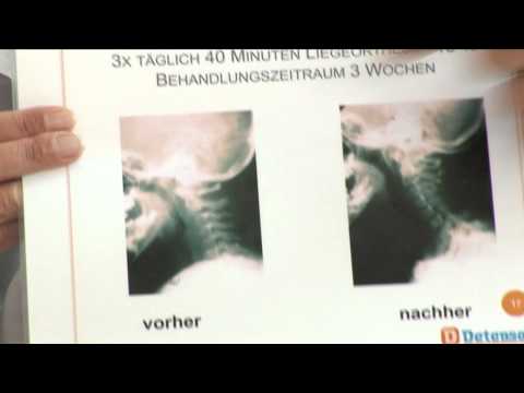 Ketonal bei der Behandlung von Gelenken Schmerzende Gelenke und Temperatur