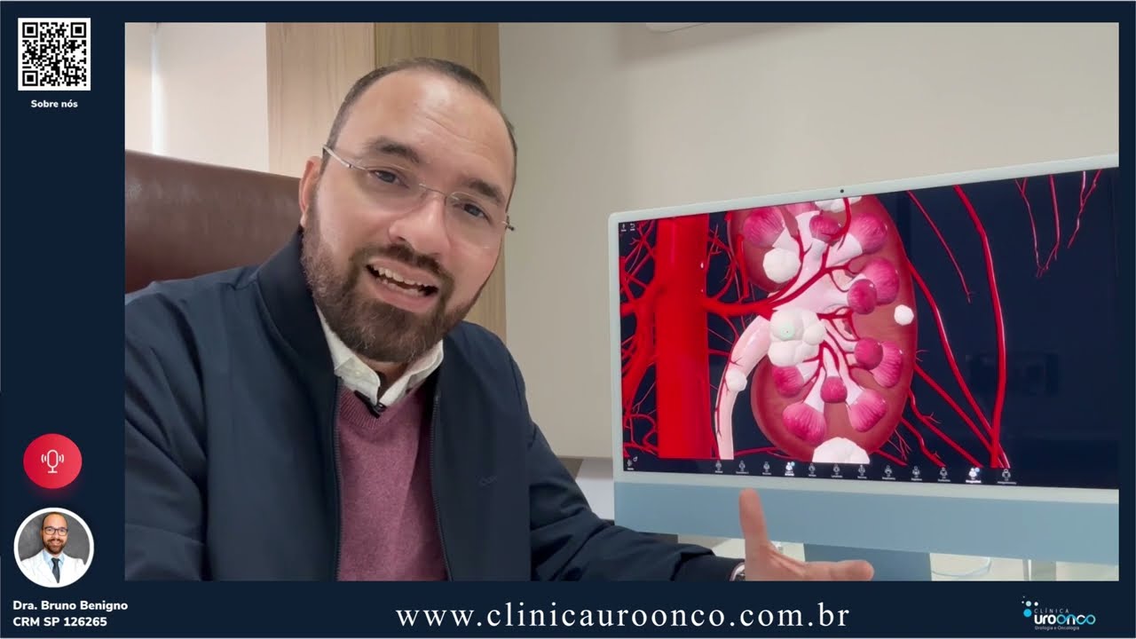 Como é possível tratar um nódulo no rim sem a retirada total do órgão? Nefrectomia parcial robótica