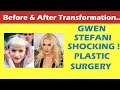 Gwen Stefani Plastic Surgery Before and After ...