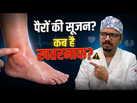 सूजे हुए पैरों को नज़रअंदाज़ न करें: ये 5 गंभीर बीमारियों का संकेत हो सकते हैं