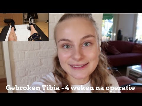 Gebroken Tibia - 4 weken na operatie