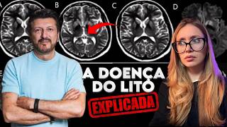 Precisamos falar sobre CREUTZFELDT-JAKOB: A MISTERIOSA DOENÇA DO LITO DO AVIÕES E MÚSICAS