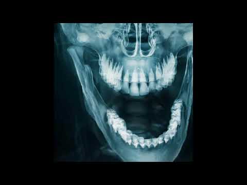 [SOLD] HIKARI ULTRA | SCARLXRD x ZILLAKAMI x SOSMULA Type Beat | CITY MORGUE Trap Metal Type Beat